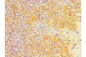 Immunohistochemistry of paraffin-embedded human tonsil tissue using ABIN7165774 at dilution of 1:100 (MTDH anticorps  (AA 1-260))