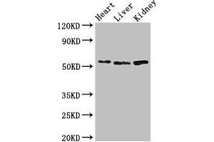 Western Blot Positive WB detected in: Mouse heart tissue, Mouse liver tissue, Mouse kidney tissue All lanes: SOX9 antibody at 3 μg/mL Secondary Goat polyclonal to rabbit IgG at 1/50000 dilution Predicted band size: 57 kDa Observed band size: 57 kDa (SOX9 anticorps  (AA 296-501))