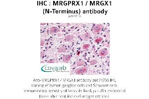 Image no. 1 for anti-MAS-Related GPR, Member X1 (MRGPRX1) (Extracellular Domain), (N-Term) antibody (ABIN1737072)