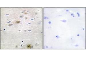 Immunohistochemistry analysis of paraffin-embedded human brain tissue, using TRA-2 alpha Antibody.