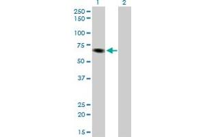 Western Blot analysis of ITPKB expression in transfected 293T cell line by ITPKB monoclonal antibody (M01), clone 2F8.