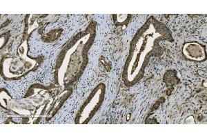 IHC analysis of PARP using anti-PARP antibody (ABIN7602276). (PARP1 anticorps  (AA 670-858))