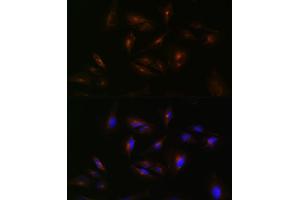 Immunofluorescence analysis of U-251 MG cells using  Rabbit pAb (ABIN7265728) at dilution of 1:100 (40x lens). (ABCA2 anticorps  (AA 2307-2466))