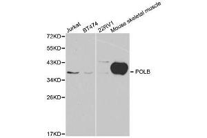 Western blot analysis of extracts of various cell lines, using POLB antibody. (POLB anticorps  (AA 1-335))