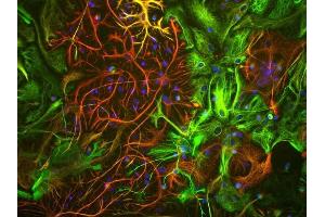 View of mixed neuron/glial cultures stained with ABIN1580468 (green) our rabbit antibody to GFAP antibody (RPCA-GFAP, red). (Vimentin anticorps)