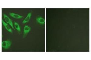 Immunofluorescence analysis of HeLa cells, using S6 Ribosomal Protein. (RPS6 anticorps  (C-Term))