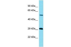 Western Blotting (WB) image for anti-Tripartite Motif Containing 43B (TRIM43B) (N-Term) antibody (ABIN2791466) (TRIM43B anticorps  (N-Term))