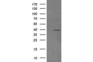 Image no. 2 for anti-Mitogen-Activated Protein Kinase Kinase 3 (MAP2K3) antibody (ABIN1499418)