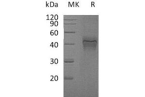 Western Blotting (WB) image for Interferon gamma Receptor 1 (IFNGR1) protein (His tag) (ABIN7320563)