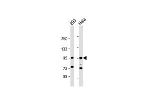 All lanes : Anti-CTNNB1Antibody (C-term) at 1:1000 dilution Lane 1: 293 whole cell lysate Lane 2: Hela whole cell lysate Lysates/proteins at 20 μg per lane. (CTNNB1 anticorps  (C-Term))