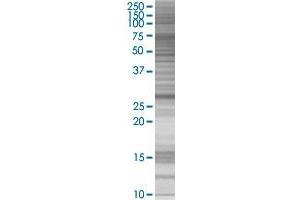 FHL2 transfected lysate. (FHL2 293T Cell Transient Overexpression Lysate(Denatured))