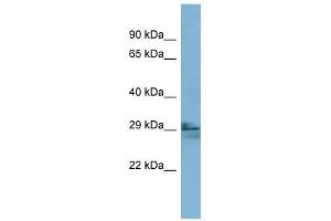 LIM2 antibody used at 1 ug/ml to detect target protein. (LIM2 anticorps  (N-Term))