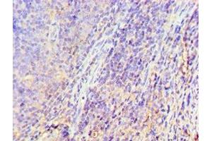 Immunohistochemistry of paraffin-embedded human tonsil tissue using ABIN7153301 at dilution of 1:100 (GRK6 anticorps  (AA 1-170))