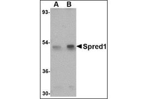 Western blot analysis of Spred1 in mouse brain tissue lysate with this product at (A) 1 and (B) 2 μg/ml. (SPRED1 anticorps  (Center))