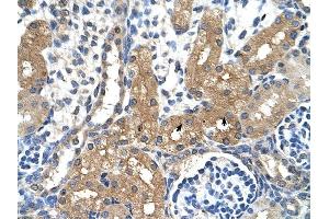 CYP4A22 antibody was used for immunohistochemistry at a concentration of 4-8 ug/ml to stain Epithelial cells of renal tubule (arrows) in Human Kidney. (CYP4A22 anticorps  (N-Term))