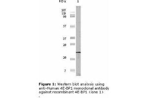 Image no. 1 for anti-Eukaryotic Translation Initiation Factor 4E Binding Protein 1 (EIF4EBP1) antibody (ABIN207632) (eIF4EBP1 anticorps)