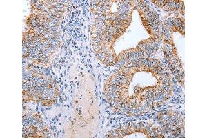 Immunohistochemistry (IHC) image for anti-Claudin 3 (CLDN3) antibody (ABIN3017040) (Claudin 3 anticorps)