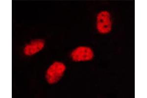 ABIN6267333 staining HeLa cells by ICC/IF.