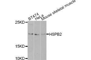 Western blot analysis of extracts of various cell lines, using HSPB2 antibody (ABIN5971309) at 1/1000 dilution. (HSPB2 anticorps)