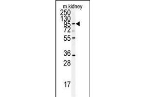 Western blot analysis of anti-AD Antibody (N-term) (ABIN391640 and ABIN2841551) in mouse kidney tissue lysates (35 μg/lane). (ADAM9 anticorps  (N-Term))