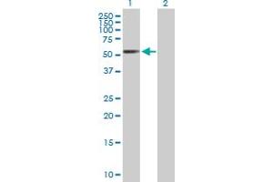 Western Blot analysis of RARB expression in transfected 293T cell line by RARB MaxPab polyclonal antibody.
