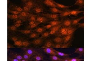 Immunofluorescence analysis of C6 cells using YAP1 Polyclonal Antibody at dilution of 1:100. (YAP1 anticorps)