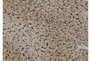 ABIN6256764 and ABIN6267179 at 1/100 staining Mouse liver tissue by IHC-P. (SHP1 anticorps  (pTyr564))
