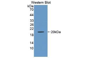Western blot analysis of the recombinant protein. (BAFF anticorps  (AA 45-169))