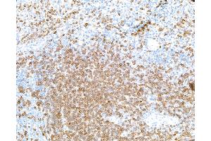 Immunohistochemistry (IHC) image for anti-CD3 epsilon (CD3E) (AA 139-189) antibody (ABIN7454000) (Recombinant CD3 epsilon anticorps  (AA 139-189))