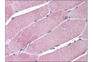 Human Skeletal Muscle: Formalin-Fixed, Paraffin-Embedded (FFPE) (TRIM7 anticorps  (C-Term))