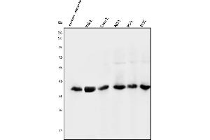Western blot analysis of NMI using anti-NMI antibody (ABIN3043451). (NMI anticorps  (AA 2-307))