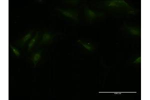 Immunofluorescence of monoclonal antibody to BTBD9 on HeLa cell. (BTBD9 anticorps  (AA 2-70))
