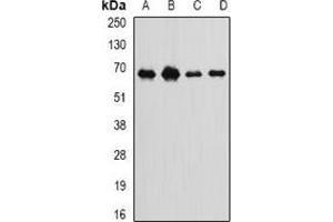 Western blot analysis of Int11 expression in SKOV3 (A), MCF7 (B), mouse spleen (C), rat liver (D) whole cell lysates.