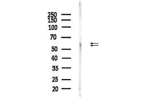 anti-N-Myc Proto-Oncogene Protein (MYCN) (Internal Region) antibody