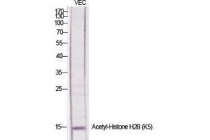 Western Blot (WB) analysis of specific cells using Acetyl-Histone H2B (K5) Polyclonal Antibody.