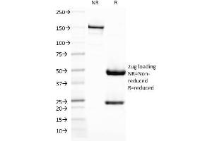 SDS-PAGE Analysis Purified CD209 Mouse Monoclonal Antibody (C209/1781).