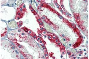 Kidney, Human: Formalin-Fixed, Paraffin-Embedded (FFPE) (Cytokeratin 18 anticorps)