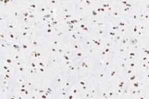 Immunohistochemistry analysis of paraffin-embedded rat substantia nigra using Ring1A (ABIN7075467) at dilution of 1: 3600 (RING1 anticorps)