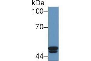 Detection of PSMC4 in Human Jurkat cell lysate using Polyclonal Antibody to Proteasome 26S Subunit, ATPase 4 (PSMC4)