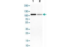 Western Blot analysis of Lane 1: MCF-7 and Lane 2: HepG2 cell lysates with HMGCR monoclonal antibody, clone CL0260 .