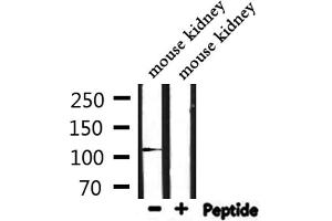 Western blot analysis of extracts from mouse kidney, using IGHMBP2 Antibody. (IGHMBP2 anticorps  (Internal Region))