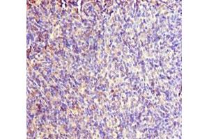 anti-Rac GTPase Activating Protein 1 (RACGAP1) (AA 353-632) antibody