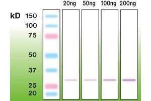 Western Blotting (WB) image for anti-C1q and Tumor Necrosis Factor Related Protein 5 (C1QTNF5) (N-Term) antibody (ABIN870333)
