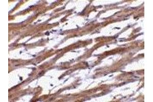 Immunohistochemistry (IHC) image for anti-B-Cell Receptor-Associated Protein 29 (BCAP29) (Middle Region) antibody (ABIN1030880) (BCAP29 anticorps  (Middle Region))