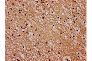 IHC image of ABIN7168574 diluted at 1:600 and staining in paraffin-embedded human brain tissue performed on a Leica BondTM system. (STH anticorps  (AA 1-128))