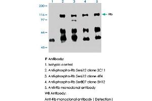 IP-Western blotting in HL-60 cell lysate using RB1 (phospho S612) monoclonal antibody, clone 3C11 (Cat # MAB0003 ; Lane 2). (Retinoblastoma 1 anticorps  (pSer612))
