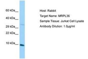 Image no. 1 for anti-BRCA1 Interacting Protein C-terminal Helicase 1 (BRIP1) (C-Term) antibody (ABIN6750116) (BRIP1 anticorps  (C-Term))