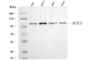Western blot analysis of SCYL2 using anti-SCYL2 antibody (ABIN7600588).