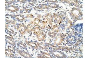 Image no. 1 for anti-Wingless-Type MMTV Integration Site Family, Member 9B (WNT9B) (AA 231-280) antibody (ABIN202335)