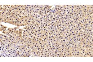 Detection of FASN in Rat Liver Tissue using Polyclonal Antibody to Fatty Acid Synthase (FASN)